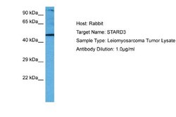 STARD3 Antibody, Novus Biologicals 100 &mu;L; Unconjugated:Antibodies,